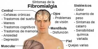 La fibromialgia explicada por el Dr. Bellver hoy en La Mañana