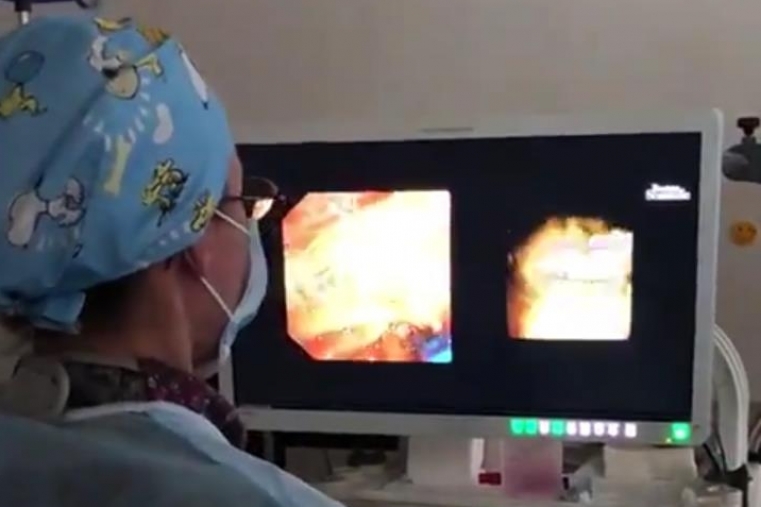 Un nuevo endoscopio de última generación evitará operaciones en Gandia