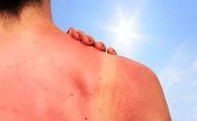 El sol y por qué hay que cuidar la piel